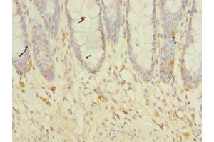 Immunohistochemistry of paraffin-embedded human colon tissue using ABIN7173211 at dilution of 1:100 (TMEM41A antibody  (AA 18-66))