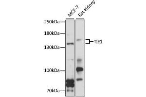 Western blot analysis of extracts of various cell lines, using TIE1 antibody (ABIN6292318) at 1:1000 dilution.