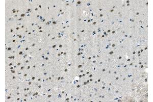 ABIN6265926 and ABIN6272455 at 1/100 staining Rat brain tissue by IHC-P. (USP36 antibody  (Internal Region))