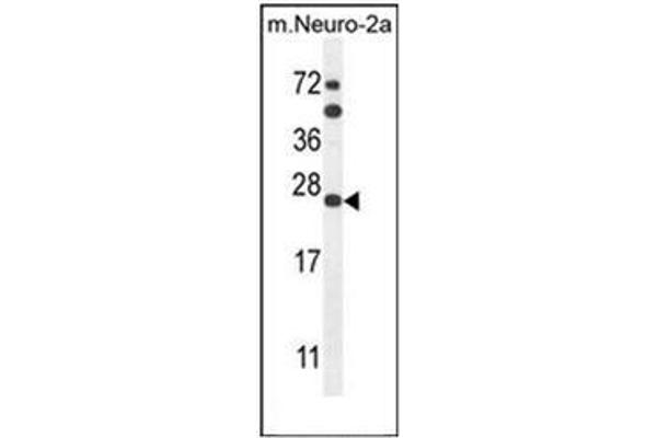 SCN1B anticorps  (N-Term)