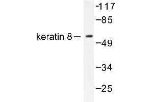 Image no. 1 for anti-Keratin 8 (KRT8) antibody (ABIN265503) (KRT8 antibody)