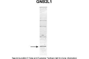 Sample Type: MCF-7 WT a whole cell lysates (110UG)Primary Dilution: 1. (GNB2L1 antibody  (C-Term))