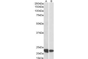 Western Blotting (WB) image for anti-Ras-Related C3 Botulinum Toxin Substrate 2 (Rho Family, Small GTP Binding Protein Rac2) (RAC2) antibody (ABIN5907554) (RAC2 antibody)