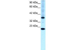 WB Suggested Anti-TFCP2L1 Antibody Titration:  0. (TFCP2L1 antibody  (N-Term))