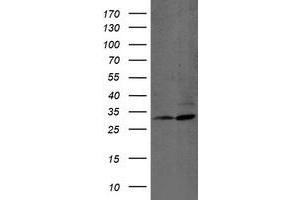 HEK293T cells were transfected with the pCMV6-ENTRY control (Left lane) or pCMV6-ENTRY PSMB7 (Right lane) cDNA for 48 hrs and lysed. (PSMB7 antibody  (AA 58-277))