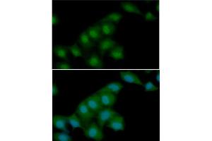 ICC/IF analysis of Visfatin in HeLa cells line, stained with DAPI (Blue) for nucleus staining and monoclonal anti-human Visfatin antibody (1:100) with goat anti-mouse IgG-Alexa fluor 488 conjugate (Green). (NAMPT antibody)