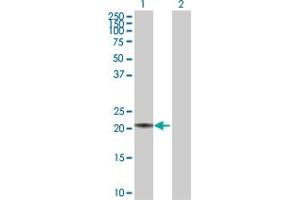 Western Blot analysis of MED18 expression in transfected 293T cell line by MED18 MaxPab polyclonal antibody. (MED18 antibody  (AA 1-208))