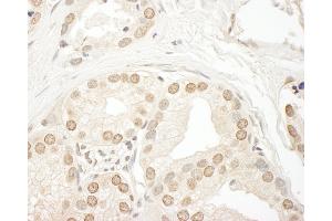 Immunohistochemistry (IHC) image for anti-Smg-9 Homolog, Nonsense Mediated mRNA Decay Factor (SMG9) (AA 75-125) antibody (ABIN7453938)