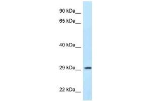 Western Blot showing PPP1R3B antibody used at a concentration of 1 ug/ml against MCF7 Cell Lysate