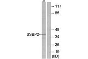 Western blot analysis of extracts from Jurkat cells, using SSBP2 Antibody.