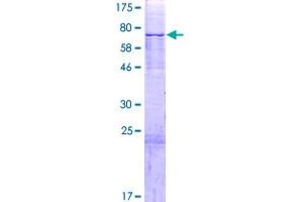 PAPD4 Protein (AA 1-484) (GST tag)