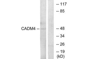Western Blotting (WB) image for anti-Cell Adhesion Molecule 4 (CADM4) (C-Term) antibody (ABIN1850236) (Cell Adhesion Molecule 4 antibody  (C-Term))