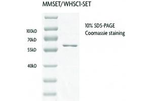 Western Blotting (WB) image for Wolf-Hirschhorn Syndrome Candidate 1 (WHSC1) (AA 942-1240) protein (GST tag) (ABIN2669720)