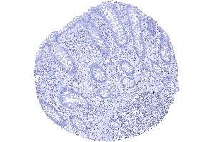 KLK7 staining is absent in all cells of the colon mucosa (Kallikrein 7 antibody)