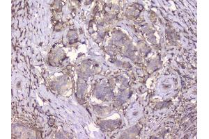 IHC analysis of Beta 2 Microglobulin using anti-Beta 2 Microglobulin antibody (ABIN6719452). (beta-2 Microglobulin antibody  (AA 22-119))