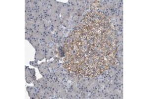 Immunohistochemical staining of human pancreas with PGBD2 polyclonal antibody  shows moderate membranous positivity in islet cells at 1:10-1:20 dilution.