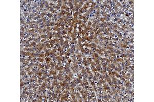 anti-Carboxylesterase 1 (CES1) (AA 99-206) antibody