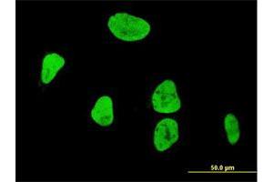 Immunofluorescence of monoclonal antibody to RUNX1 on HeLa cell. (RUNX1 antibody  (AA 210-310))