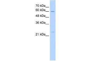 WB Suggested Anti-GINS1 Antibody Titration:  5. (GINS1 antibody  (N-Term))