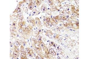 Immunohistochemistry of paraffin-embedded Human liver using CYP3A4 Polyclonal Antibody at dilution of 1:100 (40x lens). (CYP3A4 antibody)