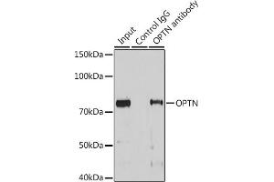 Immunoprecipitation analysis of 25 μg extracts of Mouse heart cells using 3 μg OPTN antibody (ABIN3015612, ABIN3015613, ABIN3015614 and ABIN6218972). (OPTN antibody  (AA 1-577))