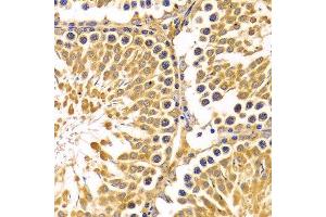 Immunohistochemistry of paraffin-embedded Rat testis using PIBF1 antibody at dilution of 1:100 (x400 lens). (PIBF1 antibody)