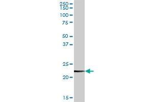 CLTB MaxPab rabbit polyclonal antibody. (CLTB antibody  (AA 1-211))
