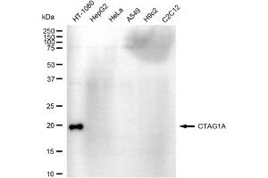 Western blotting analysis using CTAG1A antibody (ABIN7797860).