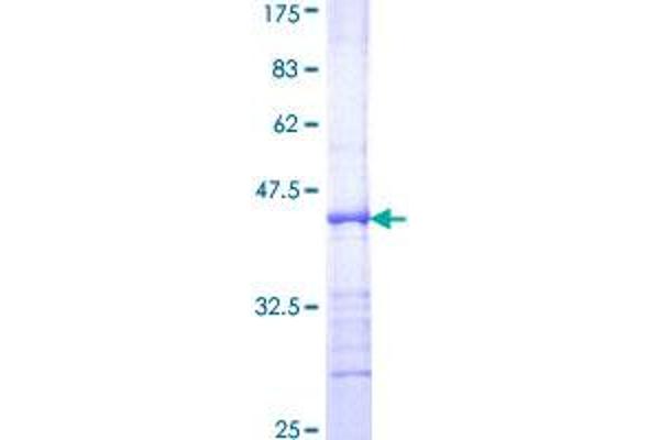 E2F2 Protein (AA 1-110) (GST tag)