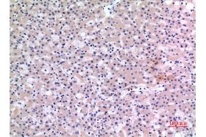 Immunohistochemical analysis of paraffin-embedded human-liver, antibody was diluted at 1:100.