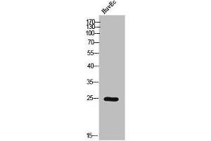 Western Blot analysis of HuvEc cells using Phospho-Casein Kinase IIβ (S209) Polyclonal Antibody (CSNK2B antibody  (pSer209))