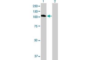 Western Blot analysis of STAT6 expression in transfected 293T cell line by STAT6 MaxPab polyclonal antibody. (STAT6 antibody  (AA 1-847))