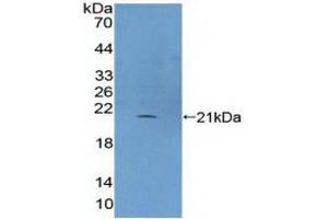 Figure. (Phospholipase C beta 3, Phosphoinositide Specific (AA 318-468) antibody)