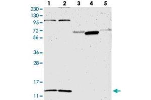 Western blot analysis of Lane 1: RT-4, Lane 2: U-251 MG, Lane 3: Human Plasma, Lane 4: Liver, Lane 5: Tonsil with MRPL52 polyclonal antibody  at 1:250-1:500 dilution. (MRPL52 antibody)