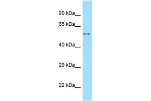 WB Suggested Anti-WASL Antibody Titration: 1. (Neural Wiskott-Aldrich syndrome protein (WASL) (Middle Region) antibody)