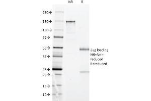 SDS-PAGE Analysis Purified HLA-DP Mouse Monoclonal Antibody (BRA-FB6).