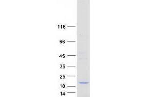 Validation with Western Blot (HDDC3 Protein (Myc-DYKDDDDK Tag))