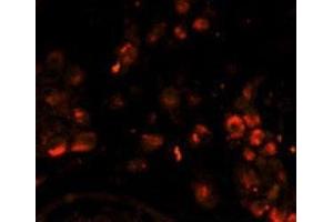 Immunofluorescence analysis of LIN28A antibody with paraffin-embedded human testis tissue. (LIN28A antibody)