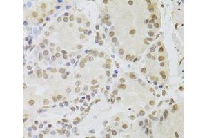 Immunohistochemistry of paraffin-embedded Human stomach using RUVBL1 Polyclonal Antibody at dilution of 1:100 (40x lens).
