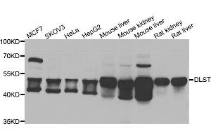 Western blot analysis of extracts of various cell lines, using DLST antibody. (DLST antibody)