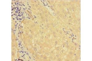 Immunohistochemistry of paraffin-embedded human liver tissue using ABIN7158728 at dilution of 1:100 (KDM1B antibody  (AA 451-544))