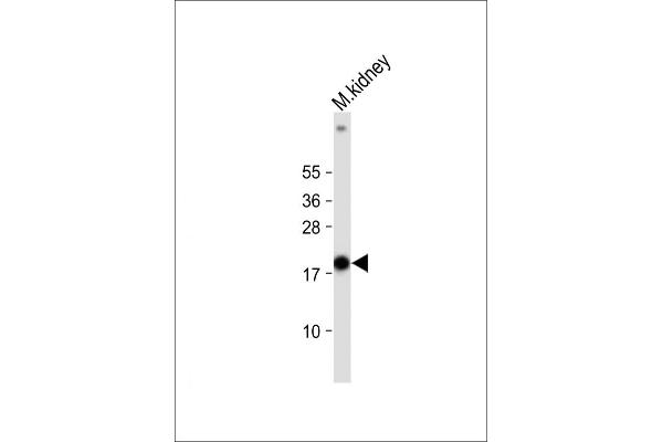 NDUFS4 antibody  (C-Term)
