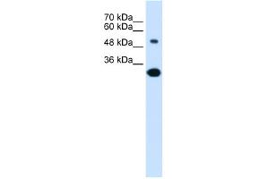 WB Suggested Anti-SLC2A5 Antibody Titration:  0. (SLC2A5 antibody  (Middle Region))