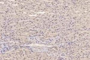 Immunohistochemistry analysis of paraffin-embedded mouse kidney using,PFDN4 (ABIN7075171) at dilution of 1: 4200 (PFDN4 antibody)