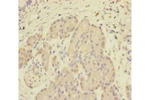 Immunohistochemistry of paraffin-embedded human pancreatic tissue using ABIN7168641 at dilution of 1:100 (SCFD1 antibody  (AA 373-642))