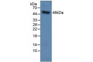Detection of Recombinant SPC, Human using Polyclonal Antibody to Surfactant Protein C (SP-C) (Surfactant Protein C antibody  (AA 24-197))