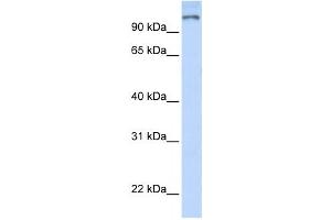 Western Blotting (WB) image for anti-Poly (ADP-Ribose) Polymerase Family, Member 9 (PARP9) antibody (ABIN2458048)