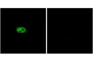 Immunofluorescence analysis of A549 cells, using NK3R Antibody. (TACR3 antibody  (AA 401-450))
