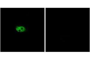 Immunofluorescence analysis of A549 cells, using NK3R Antibody.