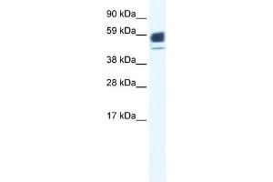 WB Suggested Anti-CHRNA1 Antibody Titration:  0.